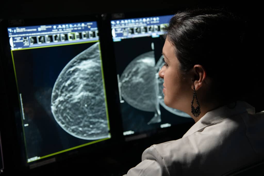 Breast Imaging Mammography